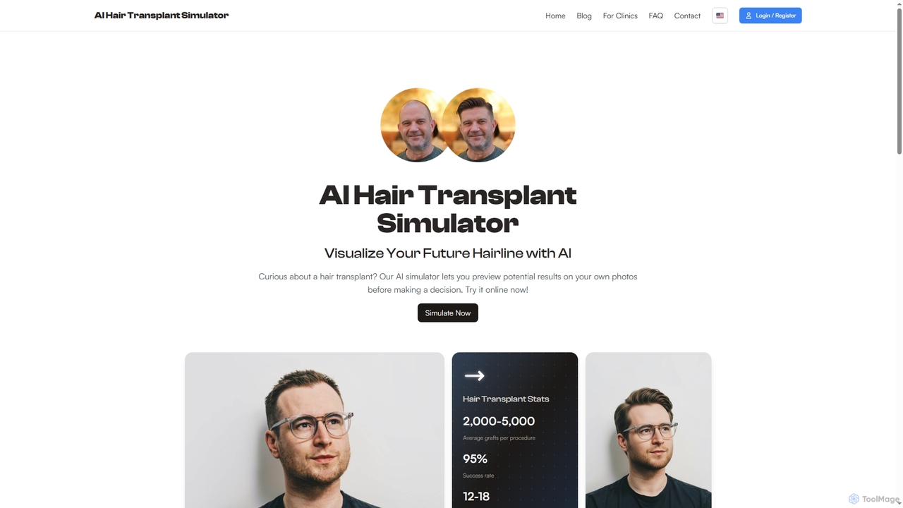 Aihairtransplant
